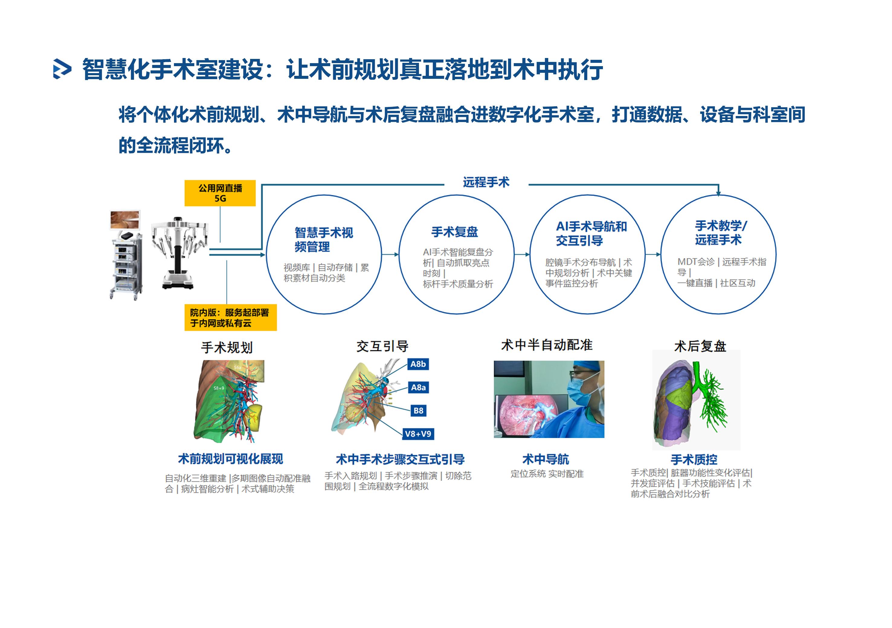 MIMICS AI 三维医学影像解决方案第 8 页：智慧化手术室建设